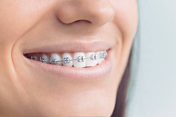 Best Full Mouth Reconstruction  in San Diego Country Estates, CA